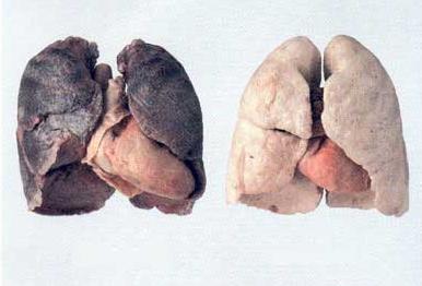 fumeurs....